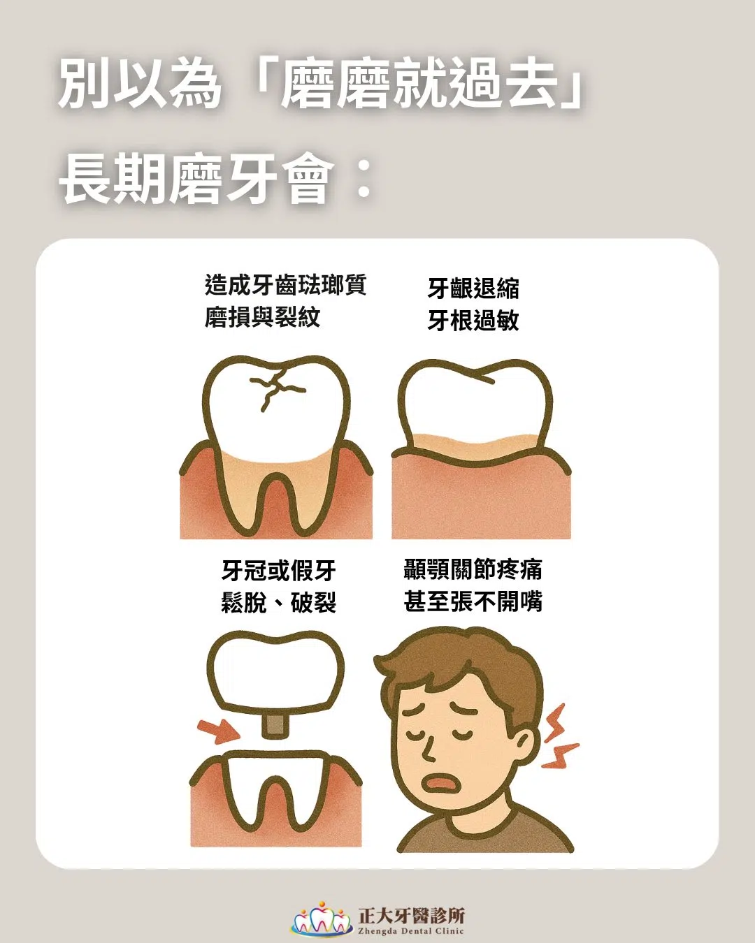 半夜磨牙不自知?這些症狀你中了嗎? 半夜磨牙不自知?這些症狀你中了嗎?